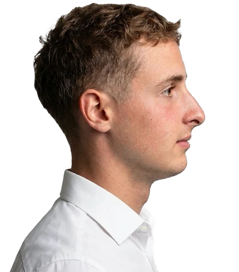 Maximilian Pazer, side profile
